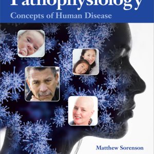 Pathophysiology Concepts of Human Disease, 1st Edition by Matthew Sorenson Test Bank