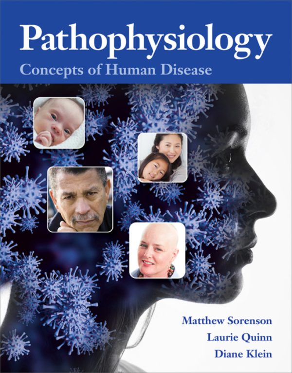 Pathophysiology Concepts of Human Disease, 1st Edition by Matthew Sorenson Test Bank